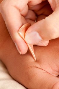 Child acupuncture, colorado springs acupuncture