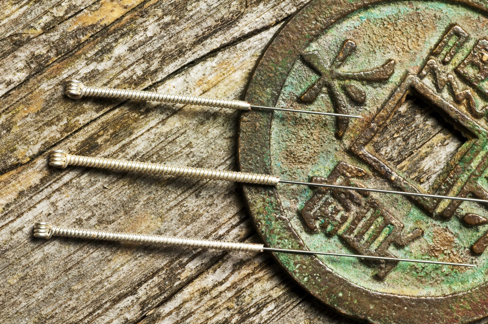 What is Acupuncture, Colorado Springs Acupuncture